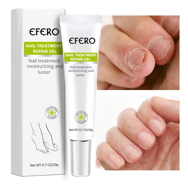 Efero® Nail Repair Gel Optimal Houses
